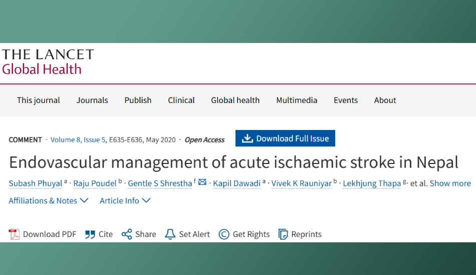 Endovascular management of acute ischaemic stroke in Nepal